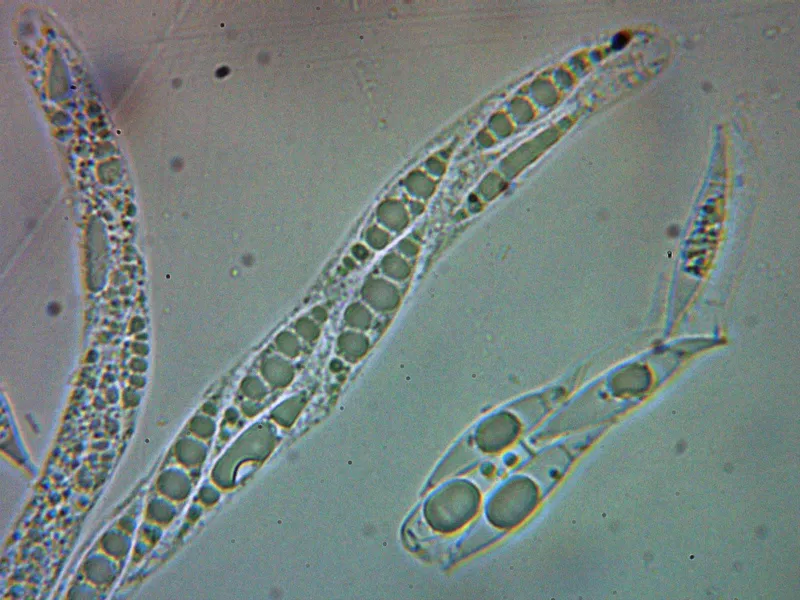 Alloanthostomella rubicola 11 - Ascos agua 2